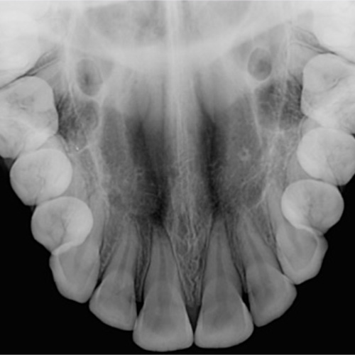 P.A. de Mandíbula - Unimagem Radiografia Odontológica Curitiba