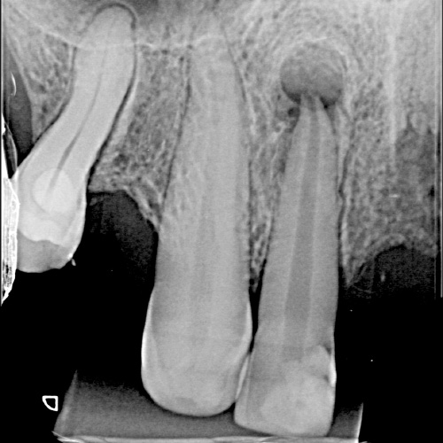 P.A. de Mandíbula - Unimagem Radiografia Odontológica Curitiba