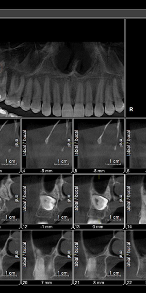 tomografia-computadorizada-unimage